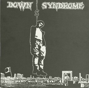 45 down syndrome st ep