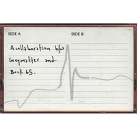 Johnny Rockwell vs. Henry Krinkle