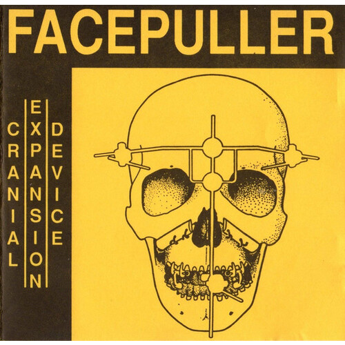 Cranial Expansion Device